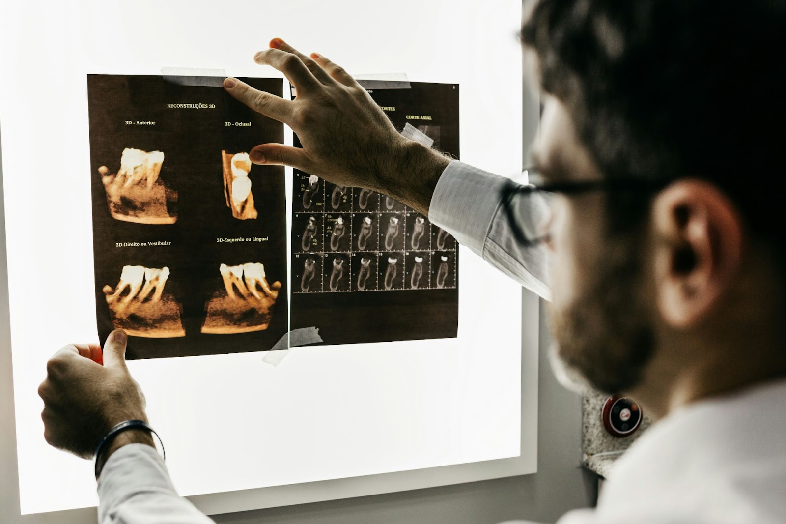 A male doctor with glasses holding x-rays up against the light in order to make an assessment.