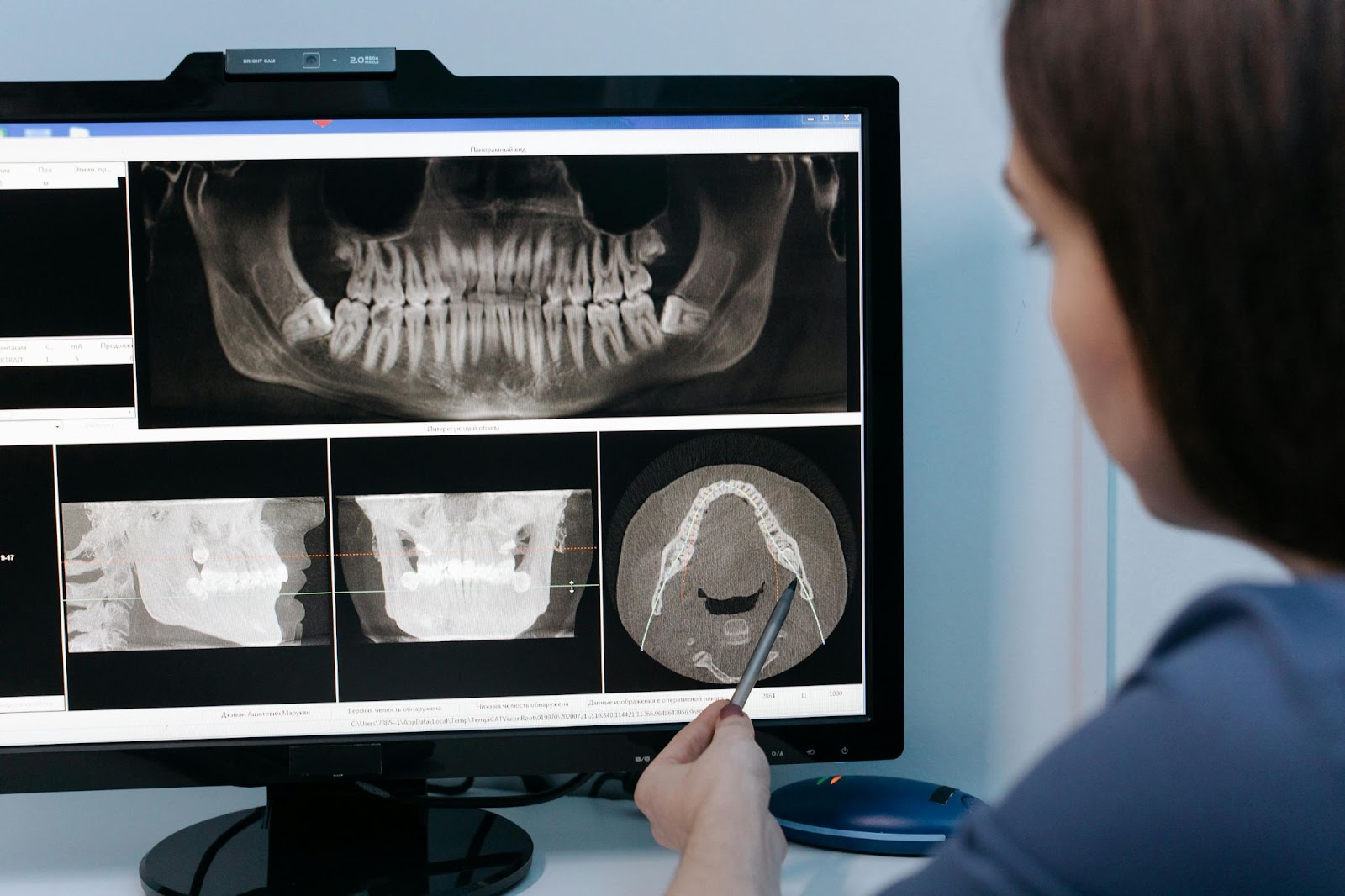 Dentist looking at patient X-rays to in order to determine treatment.